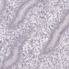 Immunohistochemical staining of human endometrium shows low expression as expected.