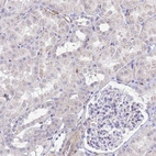 Immunohistochemical staining of human kidney shows low expression as expected.