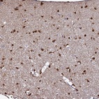 Immunohistochemical staining of human cerebral cortex shows high expression.