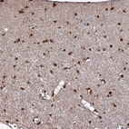 Immunohistochemical staining of human cerebral cortex shows high expression.