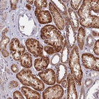 Anti-SOGA1 Antibody