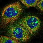 Immunofluorescent staining of human cell line A-431 shows localization to nucleoli & cytosol.