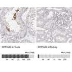 Anti-SPATA24 Antibody