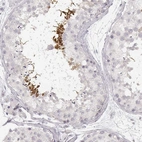 Immunohistochemical staining of human testis shows high expression.