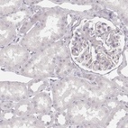 Immunohistochemical staining of human kidney shows low expression as expected.