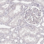 Immunohistochemical staining of human kidney shows low expression as expected.