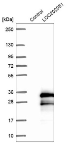 Western blot analysis in control (vector only transfected HEK293T lysate) and LY403779 over-expression lysate (Co-expressed with a C-terminal myc-DDK tag (~3.1 kDa) in mammalian HEK293T cells, LY403779).