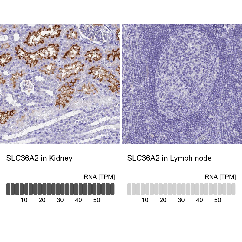 Anti-SLC36A2 Antibody