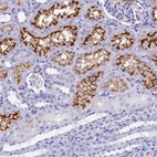 Immunohistochemical staining of human kidney shows high expression.