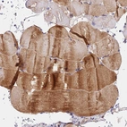 Anti-NDUFB6 Antibody