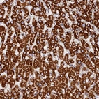 Immunohistochemical staining of human liver shows strong cytoplasmic positivity in hepatocytes.