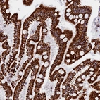 Immunohistochemical staining of human duodenum shows strong cytoplasmic positivity in glandular cells.