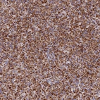 Immunohistochemical staining of human pancreas shows strong cytoplasmic positivity in exocrine glandular cells.