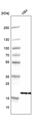 Western blot analysis in human cell line NB4.