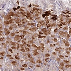 Anti-METTL26 Antibody