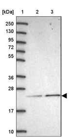 Lane 1: Marker [kDa] 250, 130, 95, 72, 55, 36, 28, 17, 10_br/_Lane 2: Human cell line RT-4_br/_Lane 3: Human cell line U-251MG sp