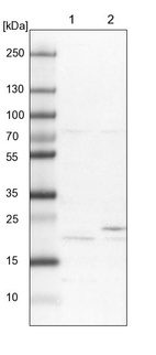 Lane 1: NIH-3T3 cell lysate (Mouse embryonic fibroblast cells)_br/_Lane 2: NBT-II cell lysate (Rat Wistar bladder tumour cells)