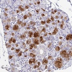 Immunohistochemical staining of human salivary gland shows high expression.