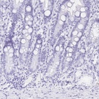 Immunohistochemical staining of human duodenum shows low expression as expected.