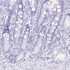 Immunohistochemical staining of human duodenum shows low expression as expected.