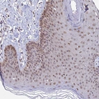 Immunohistochemical staining of human skin shows moderate nuclear positivity in squamous epithelial cells.