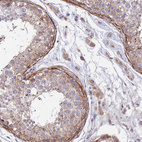 Immunohistochemical staining of human testis shows strong cytoplasmic positivity in peritubular myoid cells and leydig cells.