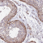 Immunohistochemical staining of human testis shows strong cytoplasmic positivity in peritubular myoid cells and leydig cells.
