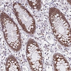 Immunohistochemical staining of human colon shows strong nuclear positivity in glandular cells.