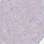 Immunohistochemical staining of human skeletal muscle shows no positivity in myocytes as expected.