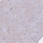 Immunohistochemical staining of human skeletal muscle shows no positivity in myocytes as expected.