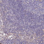 Immunohistochemical staining of human lymph node shows no cytoplasmic positivity in germinal and non-germinal center cells.