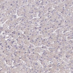 Immunohistochemical staining of human liver shows very weak cytoplasmic positivity in hepatocytes.
