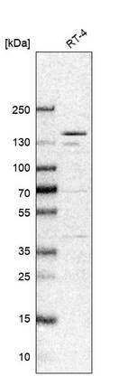 Western blot analysis in human cell line RT-4.