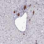 Anti-POLR2J Antibody