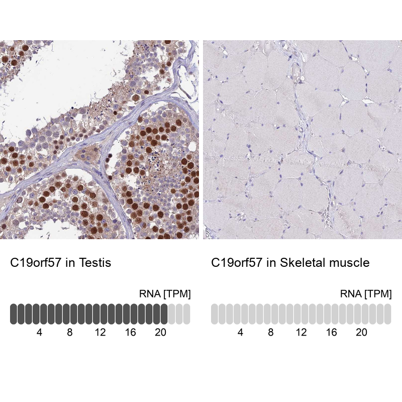Anti-C19orf57 Antibody