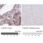 Anti-C19orf57 Antibody