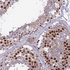 Immunohistochemical staining of human testis shows high expression.