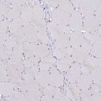 Immunohistochemical staining of human skeletal muscle shows low expression as expected.