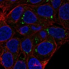 Anti-FAM149A Antibody