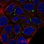 Anti-FAM149A Antibody