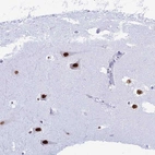 Anti-RNPS1 Antibody