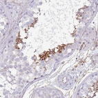 Anti-NBPF3 Antibody