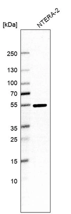 Western blot analysis in human cell line NTERA-2.