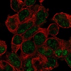 Immunofluorescent staining of human cell line HEK 293 shows localization to nucleoplasm.