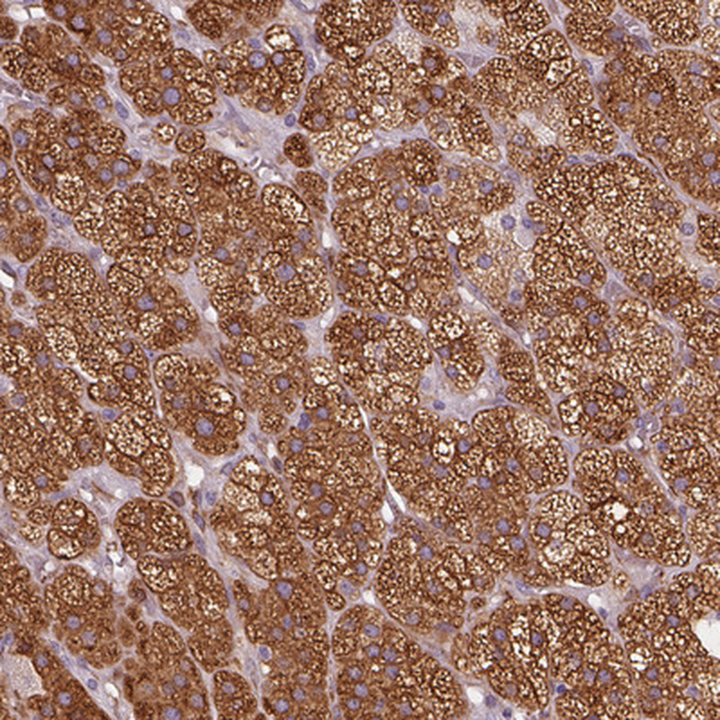 Anti-HSD3B1 Antibody
