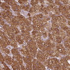 Anti-HSD3B1 Antibody