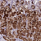 Anti-MB21D2 Antibody