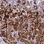 Anti-MB21D2 Antibody
