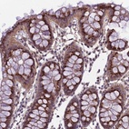 Anti-EMILIN3 Antibody