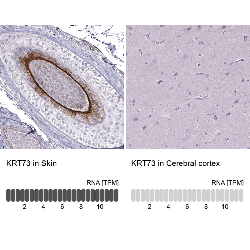 Anti-KRT73 Antibody